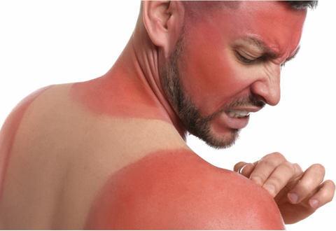 What Are Sun Supplements and How Do They Work?