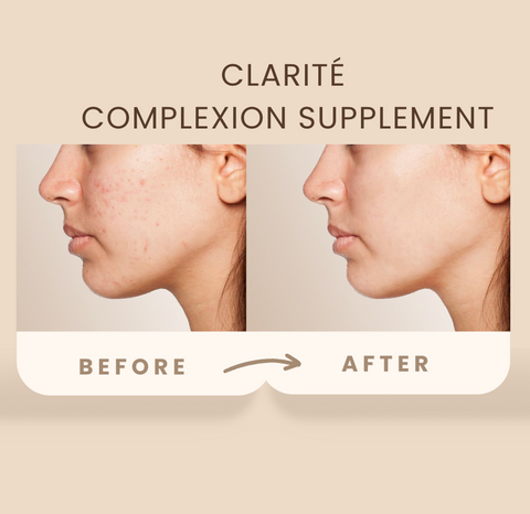 Clarité Complexion Supplement