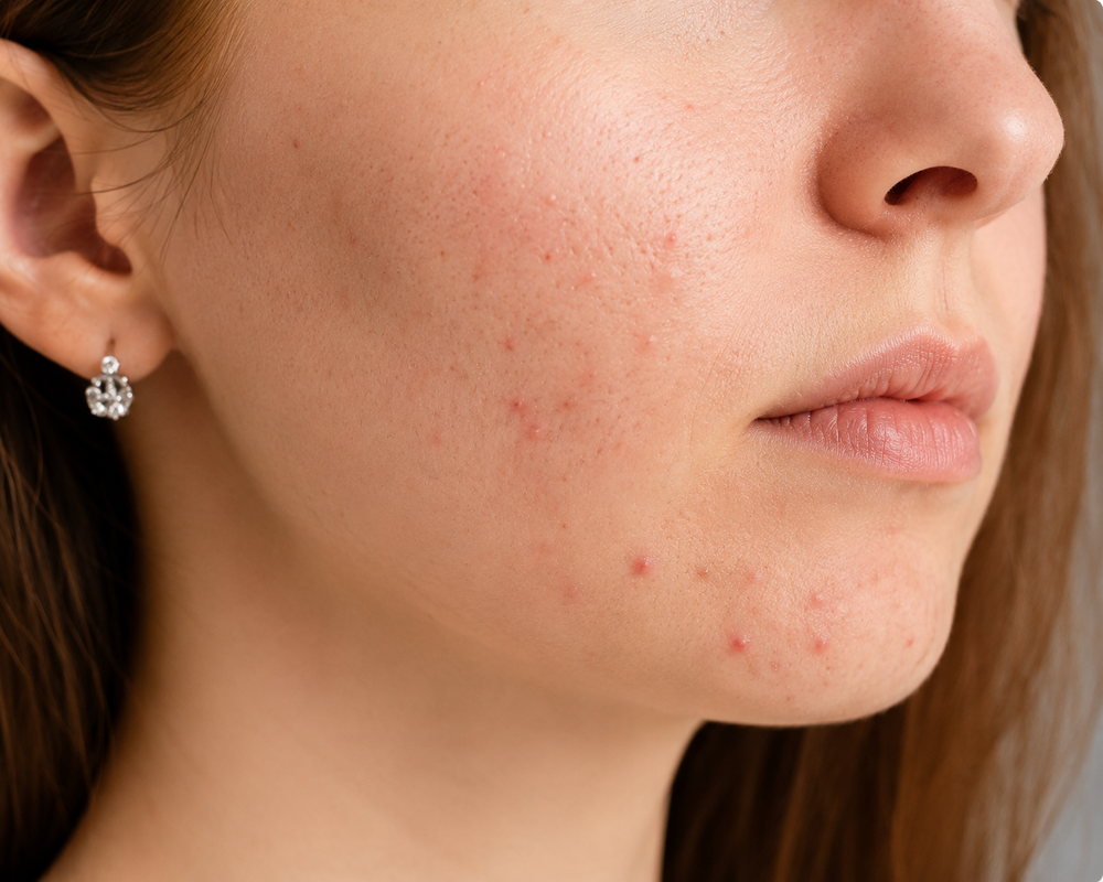 Clearer-looking complexion