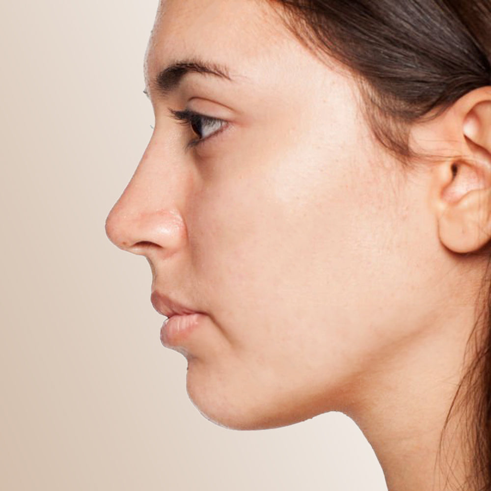 Barrier Care: Balanced vs. Stressed Skin